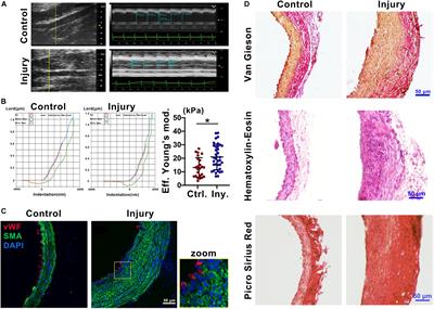 Platelet-Derived Extracellular Vesicles Increase Col8a1 Secretion and Vascular Stiffness in Intimal Injury